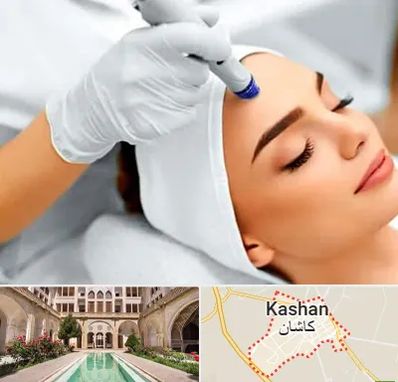 آموزش مزوتراپی در کاشان