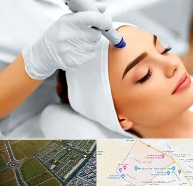 آموزش مزوتراپی در الهیه مشهد 