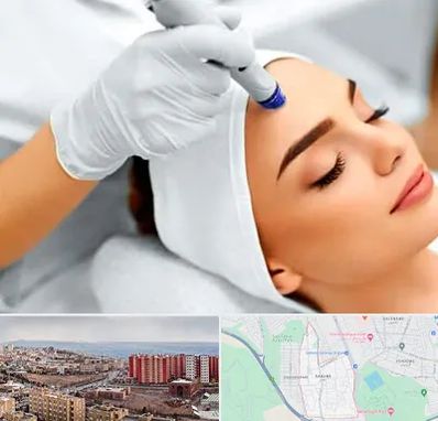 آموزش مزوتراپی در سهند تبریز