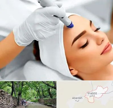 آموزش مزوتراپی در شاندیز مشهد