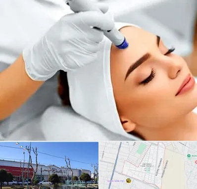آموزش مزوتراپی در فاز دو اندیشه