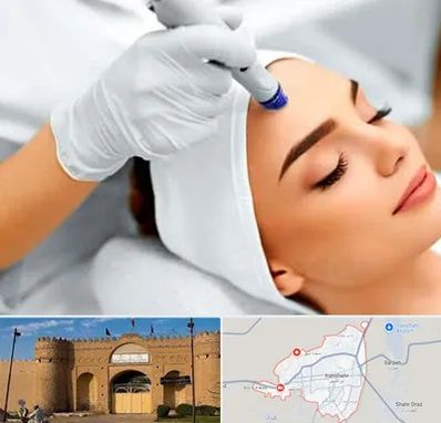 آموزش مزوتراپی در ایرانشهر