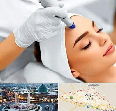 آموزش مزوتراپی در زنجان