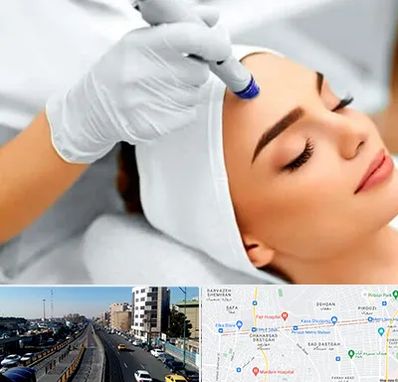 آموزش مزوتراپی در پیروزی