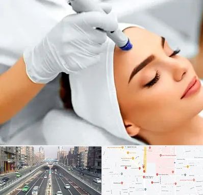 آموزش مزوتراپی در توحید 