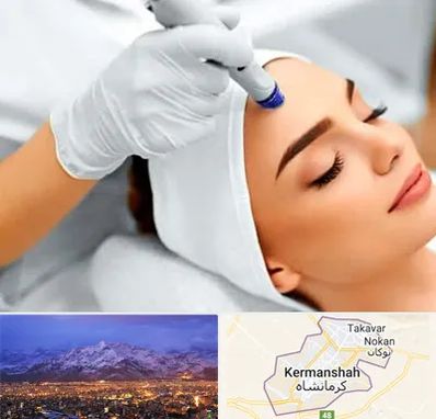 آموزش مزوتراپی در کرمانشاه