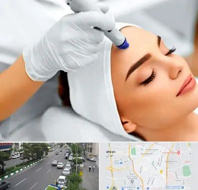 آموزش مزوتراپی در ستارخان 