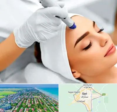 آموزش مزوتراپی در ساری