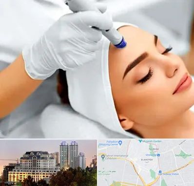 آموزش مزوتراپی در فرشته 