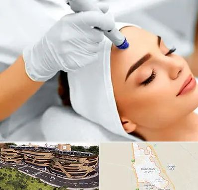 آموزش مزوتراپی در شاهین شهر