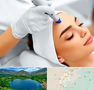 آموزش مزوتراپی در رودبار