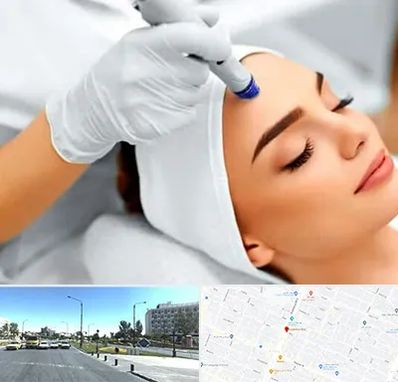 آموزش مزوتراپی در بلوار کلاهدوز مشهد 