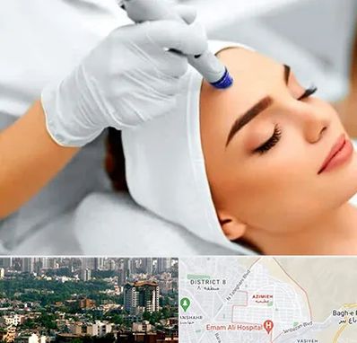 آموزش مزوتراپی در عظیمیه کرج 