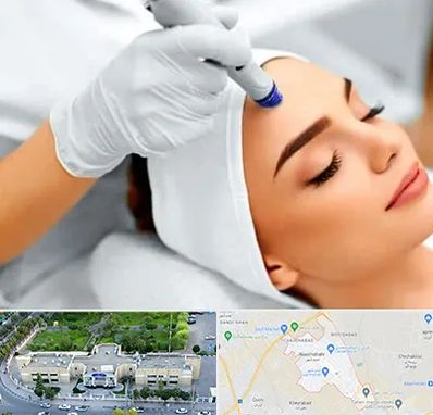 آموزش مزوتراپی در نسیم شهر