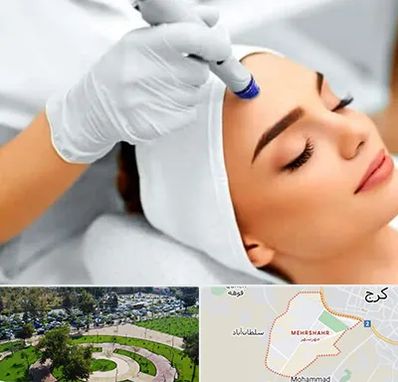 آموزش مزوتراپی در مهرشهر کرج 