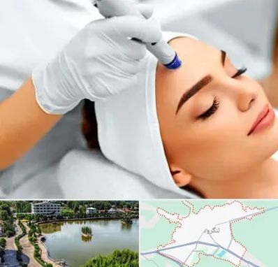 آموزش مزوتراپی در لنگرود