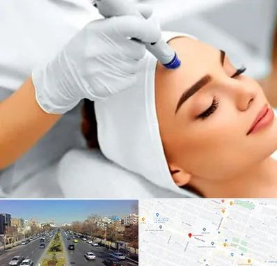 آموزش مزوتراپی در بلوار معلم مشهد 