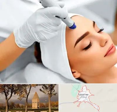 آموزش مزوتراپی در تویسرکان