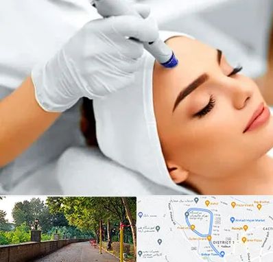 آموزش مزوتراپی در فلکه گاز رشت 