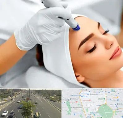 آموزش مزوتراپی در منطقه 17 تهران 