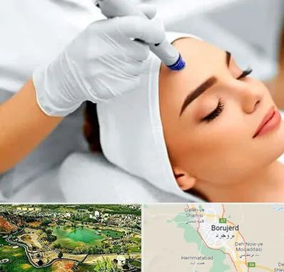 آموزش مزوتراپی در بروجرد