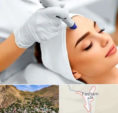 آموزش مزوتراپی در فشم