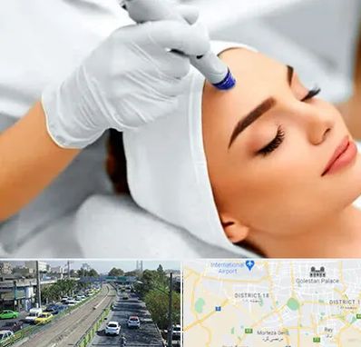 آموزش مزوتراپی در جنوب تهران 