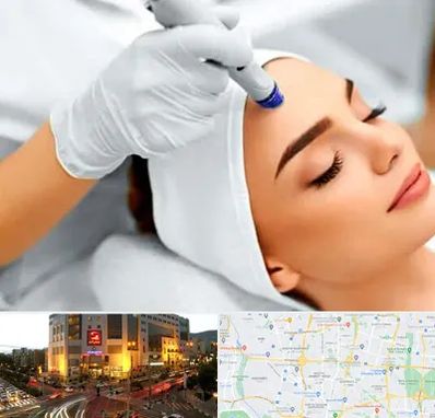 آموزش مزوتراپی در جنت آباد تهران 