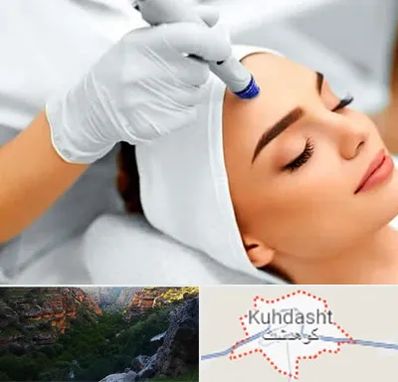 آموزش مزوتراپی در کوهدشت