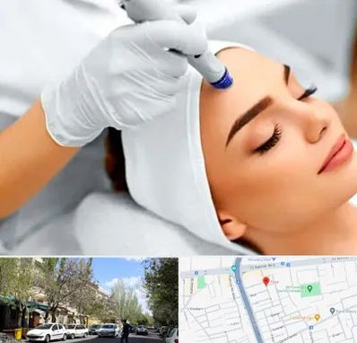 آموزش مزوتراپی در کوی فیروز تبریز