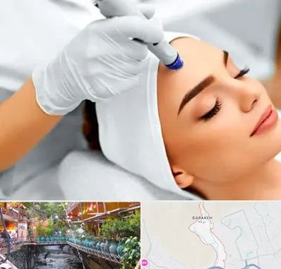 آموزش مزوتراپی در درکه