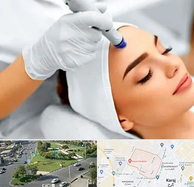 آموزش مزوتراپی در شاهین ویلا کرج 