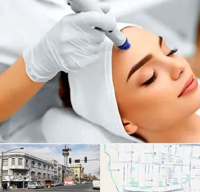 آموزش مزوتراپی در 17شهریور