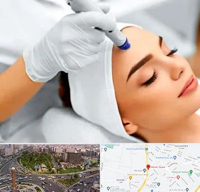 آموزش مزوتراپی در سبلان 