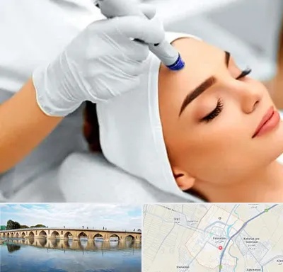 آموزش مزوتراپی در فلاورجان
