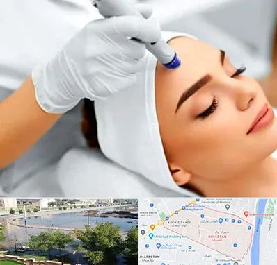 آموزش مزوتراپی در گلستان اهواز 