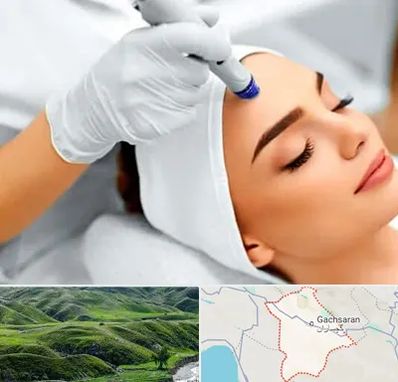 آموزش مزوتراپی در گچساران