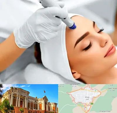 آموزش مزوتراپی در خوی