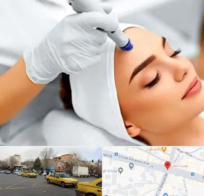 آموزش مزوتراپی در شهناز تبریز