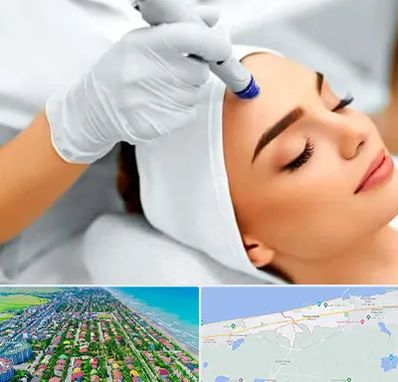 آموزش مزوتراپی در فریدونکنار