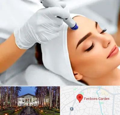 آموزش مزوتراپی در باغ فردوس