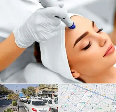 آموزش مزوتراپی در مفتح مشهد 