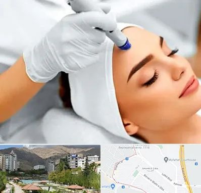 آموزش مزوتراپی در شهر زیبا 
