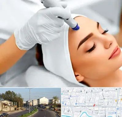 آموزش مزوتراپی در ضیابری رشت 