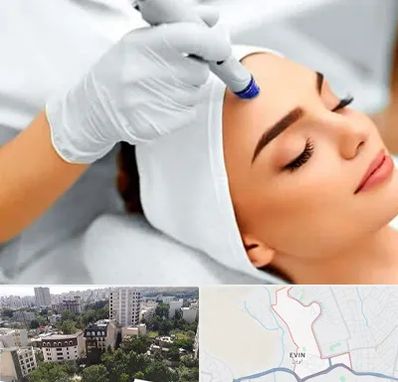 آموزش مزوتراپی در اوین