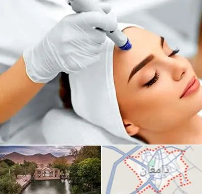 آموزش مزوتراپی در دامغان