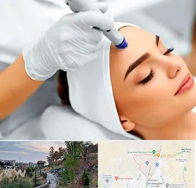 آموزش مزوتراپی در باغستان کرج 