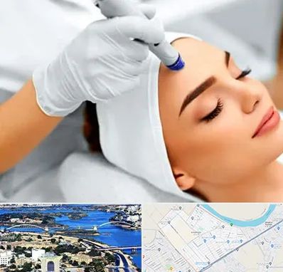 آموزش مزوتراپی در کوروش اهواز 