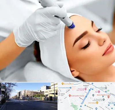 آموزش مزوتراپی در خیابان ملاصدرا شیراز 