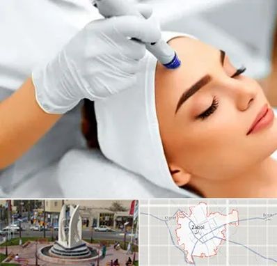 آموزش مزوتراپی در زابل